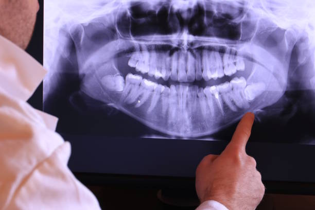 Best Emergency Gum Pain Relief  in Dallesport, WA