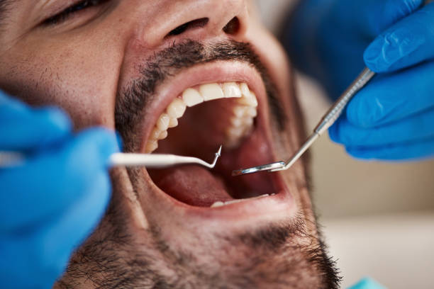 Best Dentist for Tooth Abscess  in Dallesport, WA